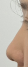 circleImage