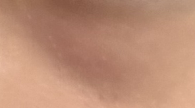 circleImage