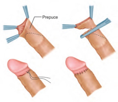circleImage