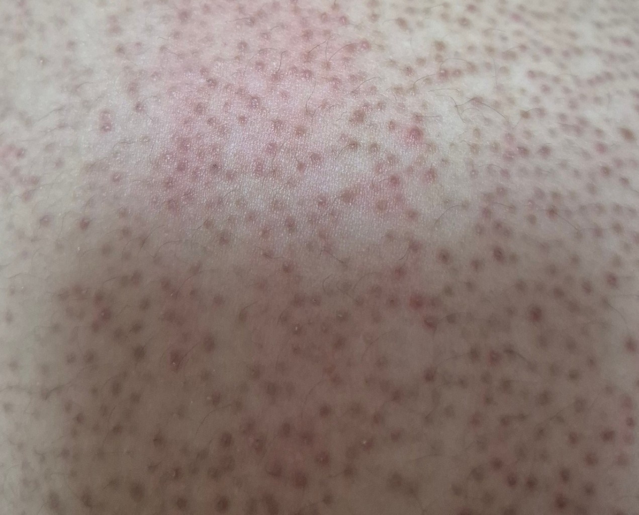 circleImage