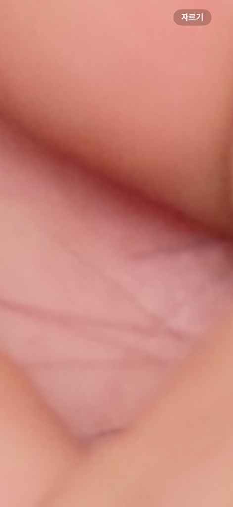circleImage