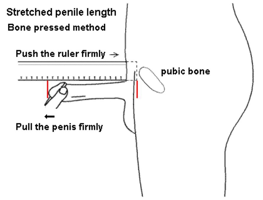 circleImage