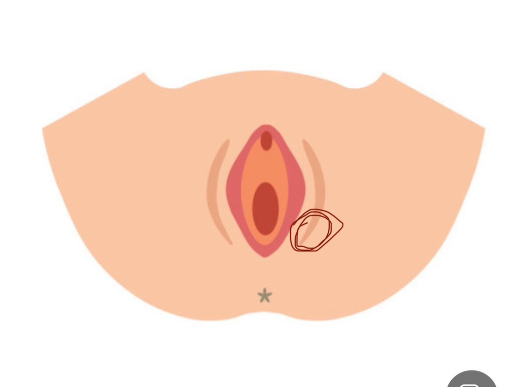 circleImage