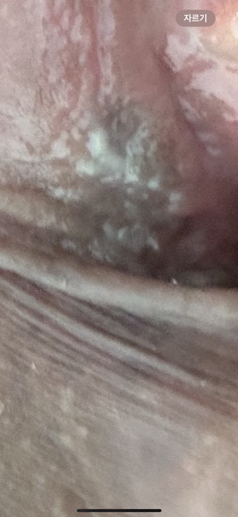 circleImage