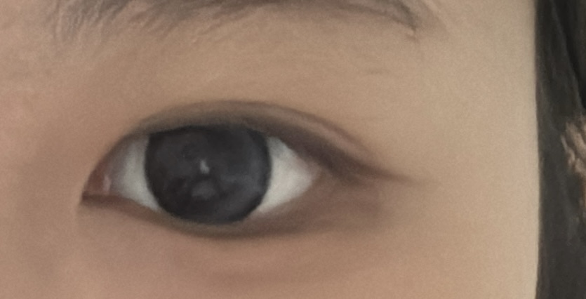 circleImage