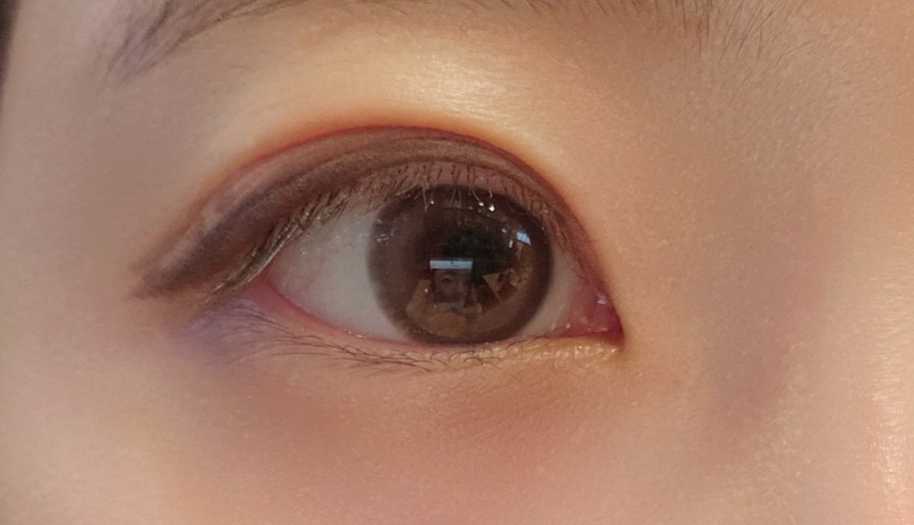 circleImage