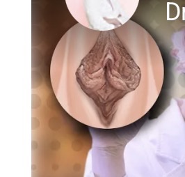 circleImage