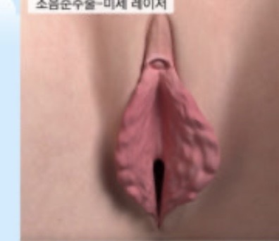 circleImage