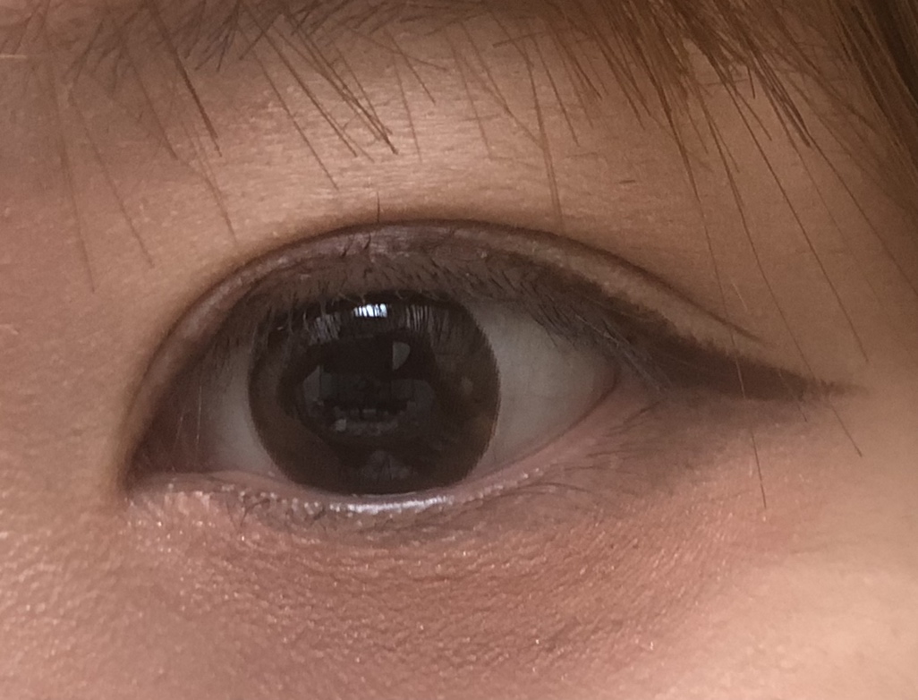 circleImage